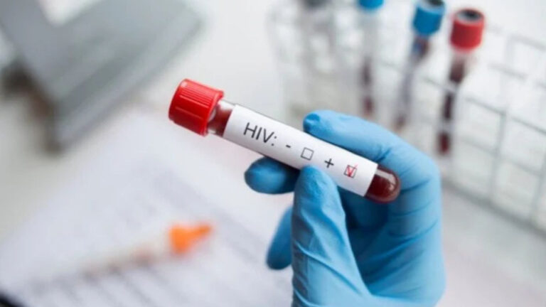 HIV cases surge sharply in Sirajganj